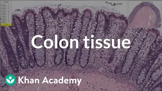 Normal colon tissue | Gastrointestinal system diseases | Health & Medicine | Khan Academy