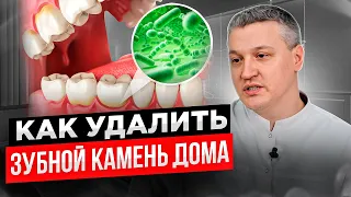 УДАЛЕНИЕ ЗУБНОГО КАМНЯ В ДОМАШНИХ УСЛОВИЯХ! Возможно ли это?