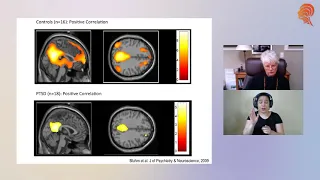 Sebern Fisher Live Stream Interview about Trauma and the Fear-Driven Brain intensive course