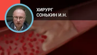 Хирург Сонькин И.Н.: Тромбозы поверхностных и глубоких вен