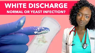 How To Stop Vaginal Yeast Infection & Itching | Vaginal Thrush Treatment | Is White Discharge Normal