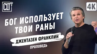 Бог использует твои раны | Джентазен Франклин | Проповедь