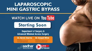 Laparoscopic Mini Gastric Bypass for Morbid Obesity (Weight Loss Surgery)