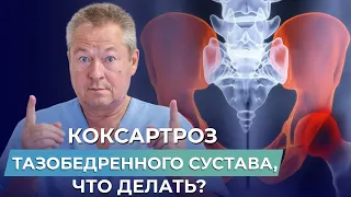 МЕНЯТЬ СУСТАВ НЕТ СМЫСЛА? Что делать при КОКСАРТРОЗЕ ТАЗОБЕДРЕННОГО СУСТАВА?