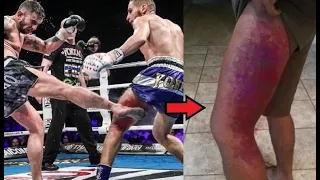 Crazy Pain... Most Brutal Low Kick KO's in Combat Sports #2