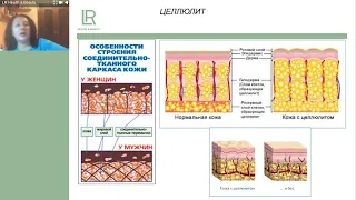 Как убрать целлюлит. Антицеллюлитная продукция LR на основе Алое Вера