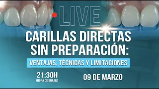 Carillas Directas sin preparación: Ventajas, Técnicas y Limitaciones