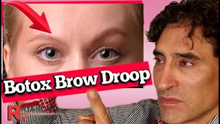 BOTOX BROW DROOP - Brow Tutorial