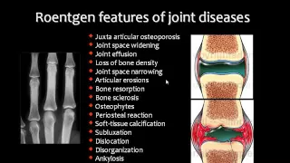 Imaging of joint diseases part 1   Dr Mamdouh Mahfouz