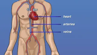 PreOp® Coronary Angioplasty with Stent Placement