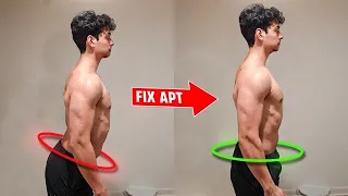 Fix Anterior Pelvic Tilt FAST: A Science Based Guide