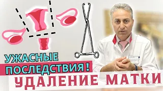 Удалять Матку или Нет в 2024 году ? | Последствия Удаления Матки | Операция при Опущении Матки