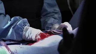 Grey's Anatomy - 2X17 Cena Da Bomba Dublado