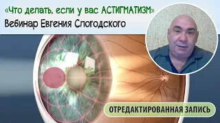 Что делать, если у вас астигматизм?