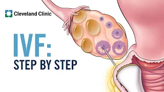 How Does In Vitro Fertilization (IVF) Work? A Step-by-Step Explanation