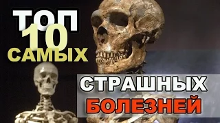 ТОП 10  САМЫЕ СТРАШНЫЕ БОЛЕЗНИ человечества ШОК!