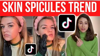 SPICULES ARE A TIKTOK SKINCARE TREND  *i have concerns*