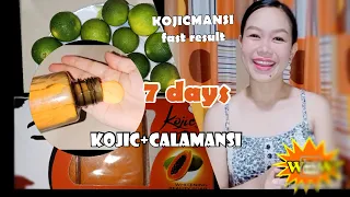 PAANO PUMUTI NG MABILIS | KOJICMANSI : INTENSE WHITENING || Effective Skin Whitening in 7 Days