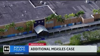 5th case of measles detected in Broward, Florida Department of Health investigates