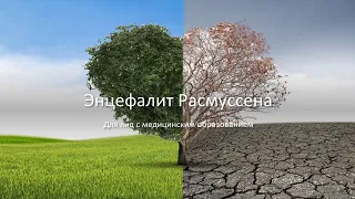 Энцефалит Расмуссена