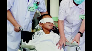 Niño chino recibe ojos artificiales