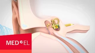 Video about Hearing and How it Works | MED-EL