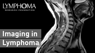 Imaging in Lymphoma with Thomas Habberman, MD | Everything You Need to Know About Blood Cancer