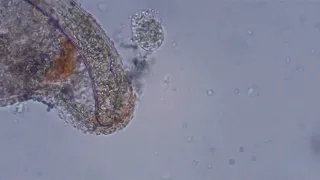 Cercaria escape from the mother sporocyst