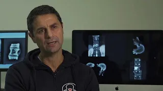 Primo trapianto mondiale di vertebre. Nuovo record del Rizzoli