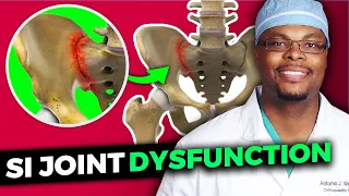 Sacroiliac Joint Dysfunction | Ask your doctor is it SI?