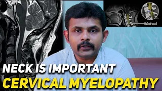 Neck is Important Cervical Myelopathy Dr. Vignesh Pushparaj | Annaamalai Ortho and Spine Center