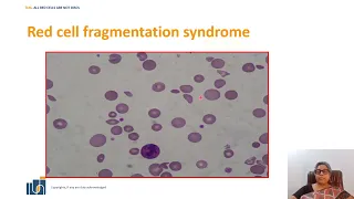 All Red Cells Are Not Discs - Module 4 | The Laboratory Matters | Dr. Rani Radhakrishnan |