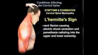 Conditions Affecting The Cervical Spine - Everything You Need To Know - Dr. Nabil Ebraheim