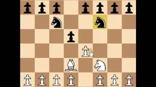 How Magnus Carlsen beat Bill Gates at Chess in 9 Moves!!