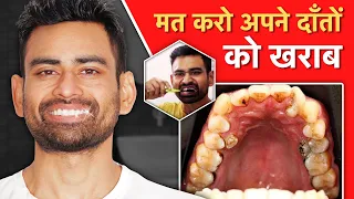 दांतो की Problems से Permanent छुटकारा पाएं (Mouth Ulcers, Bleeding Gums, Bad Breath, Cavities)