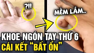 Chàng trai khoe 'NGÓN TAY THỨ 6' độc lạ, vừa nhìn dân mạng liền có 'CÙNG Ý TƯỞNG' | Tin 3 Phút