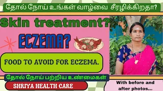 Skin treatment in tamil.| food to avoid for eczema...