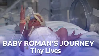 Premature Baby Roman Is Struggling To Breathe | Tiny Lives | BBC Scotland