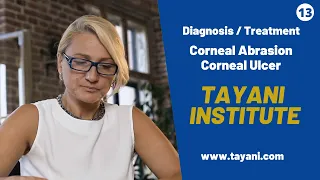 Corneal Abrasion Corneal Ulcer / What Is It? | Tayani Institute