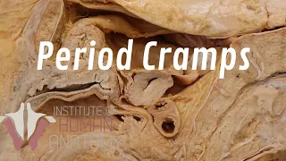 What Are Period Cramps?