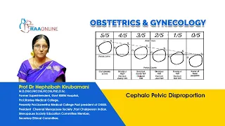 Cephalo Pelvic Disproportion - MD/DNB Obstetrics & Gynaecology