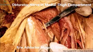 OBTURATOR NERVE FEMORAL POPLITEAL ARTERIES Angiograms and Clinical Aspects – Sanjoy Sanyal – Proceum