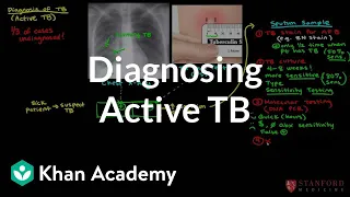 Diagnosing active TB | Infectious diseases | NCLEX-RN | Khan Academy