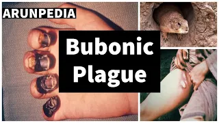 Bubonic Plague & Black Death - Explained | 3 worst pandemics ever | ARUNPEDIA | TAMIL