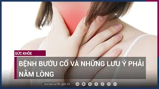 Bệnh bướu cổ và những lưu ý phải nằm lòng | VTC Now