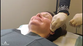 Microneedling Training Day