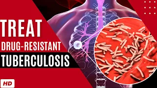 How to Treat Drug Resistant Tuberculosis