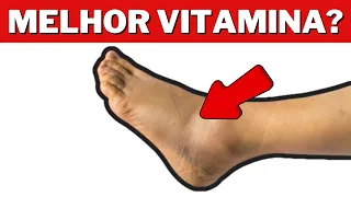 Os 5 principais nutrientes para reduzir o inchaço nos pés e nas pernas
