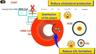 Statins, cholesterol and atherosclerosis