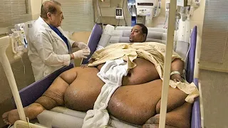 Remember This Man Who Weighed 1022 Pounds? You Won't Believe How He Looks Now!